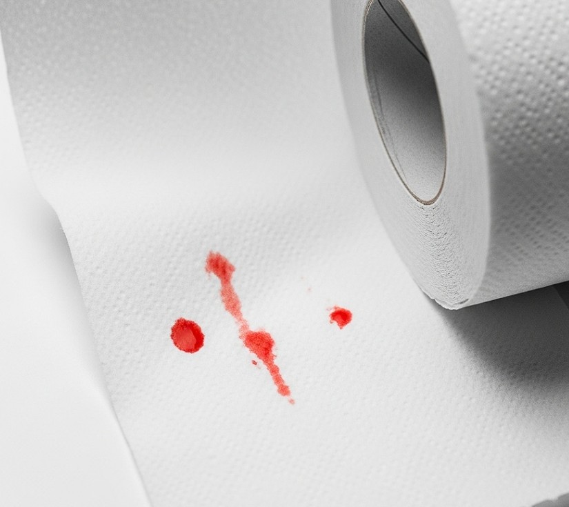 Avances en el tratamiento mínimamente invasivo para hemorroides